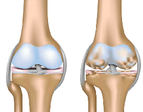 Đi bộ mỗi ngày mang lại những lợi ích gì?